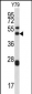 ARPC1A Antibody (Center)