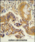 CLNS1A Antibody (Center)