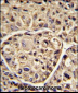 ELOVL6 Antibody (N-term)