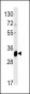 ELOVL6 Antibody (N-term)