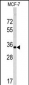 EMD Antibody (C-term)