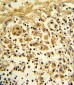 ENO1 Antibody (Center)