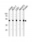 ENO1 Antibody (Center)