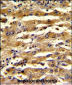 FABP3 Antibody (N-term)