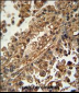 ABCG1 Antibody (N-term)