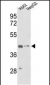 ACTG1 Antibody (Center)