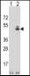 ACTG1 Antibody (Center)