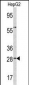 ORM1 Antibody (C-term)