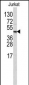 CPB2 Antibody (Center E134)