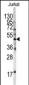 HFE Antibody (Center)