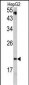 VHL Antibody (C-term)