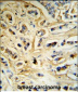 CASA Antibody (Center)