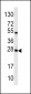 CASA Antibody (Center)