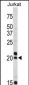 VIP Antibody (C-term)