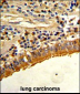 SPP1 Antibody (C-term)