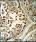 SETD8 Antibody (Center)