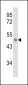 PAI2 Antibody (Center)