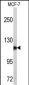 PSA Antibody (C-term)