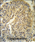 PSA Antibody (Center)