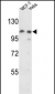 PSA Antibody (Center)