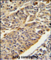 CTSE Antibody (Center)