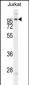 HMGCR Antibody (Center)