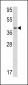 Calponin-3 Antibody (Center)