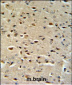 CTNA1 Antibody (N-term)