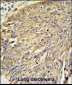 Annexin A1 Antibody (Center)