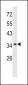 Annexin A1 Antibody (Center)