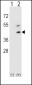 DCN Antibody (Center)