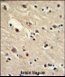 EEF1A1/ EEF1A2 Antibody (N-term)