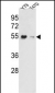 EEF1A1/ EEF1A2 Antibody (N-term)