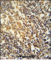 TNFAIP2 Antibody (Center)