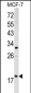 ARF3 Antibody (Center D93)