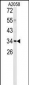 C1QTNF1 Antibody (N-term)