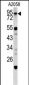 CALD1 Antibody (Center)