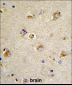 CDCA3 Antibody (N-term)