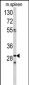 CDCA3 Antibody (N-term)