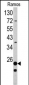 RPS9 Antibody (C-term)