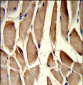 RRM2 Antibody (Center)