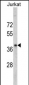 RRM2 Antibody (Center)