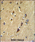 STXBP1 Antibody (Center)