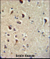 TIEG2 Antibody (N-term)