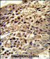 VDAC1 Antibody (Center)