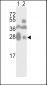 CD81 Antibody (C-term)