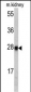 ETHE1 Antibody (Center)