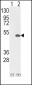 ETV4 Antibody (C-term)