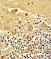 GARP Antibody (Center)