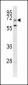 GARP Antibody (Center)